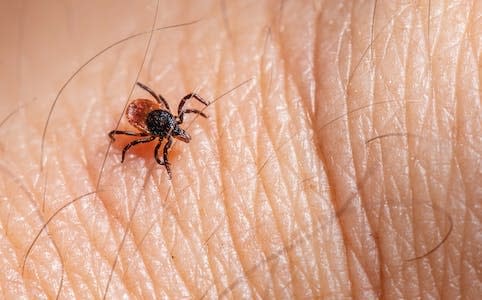 lice in your beard